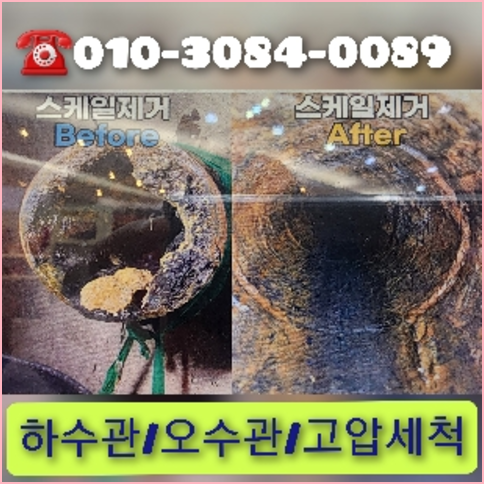요석제거